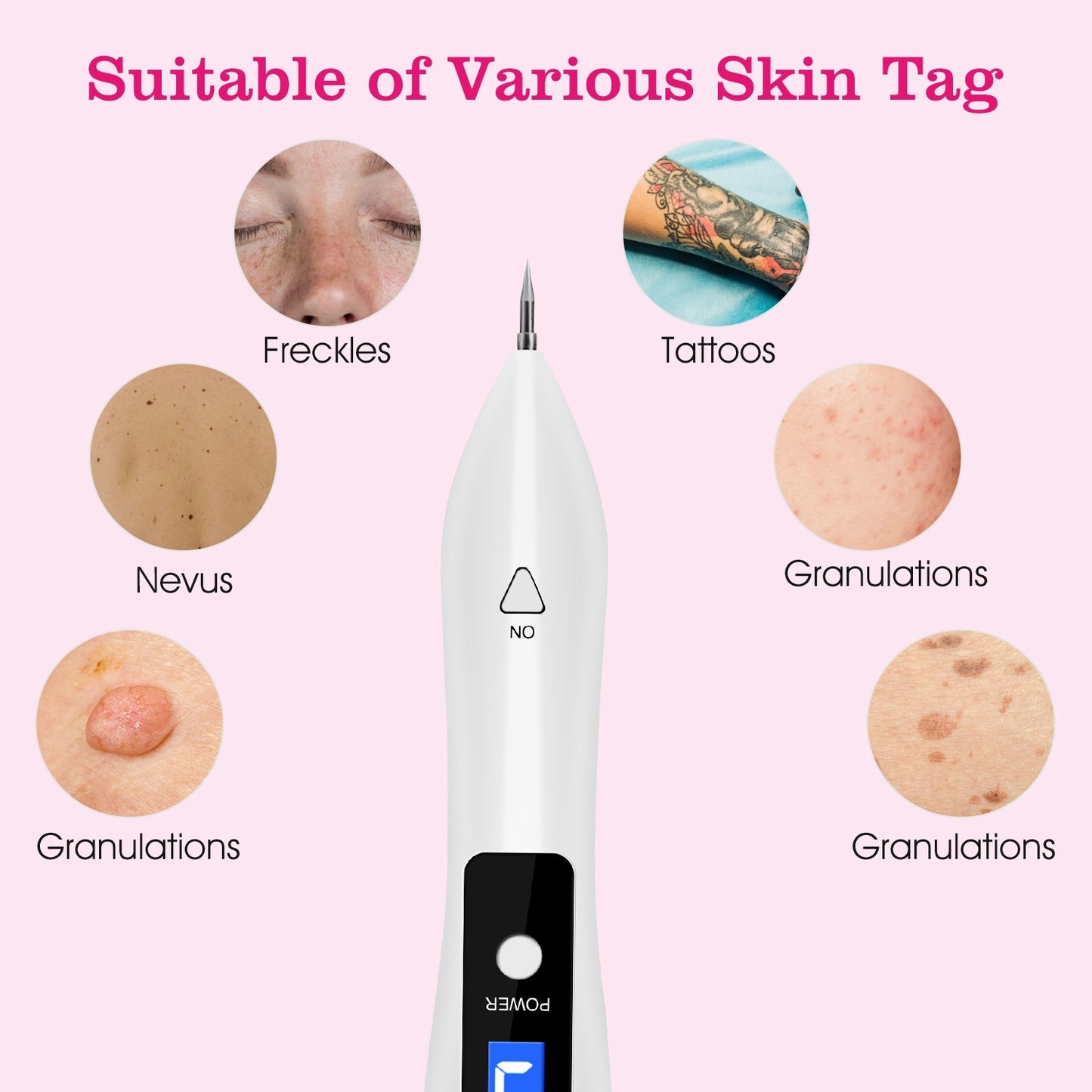 Skin Tag Repair Kit Portable Beauty Equipment Multi-Level With Home Usage USB Charging LCD Level Adjustable 6 Replaceable Needles